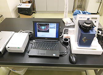 ドナー角膜用スペキュラーマイクロスコピーによる内皮細胞測定