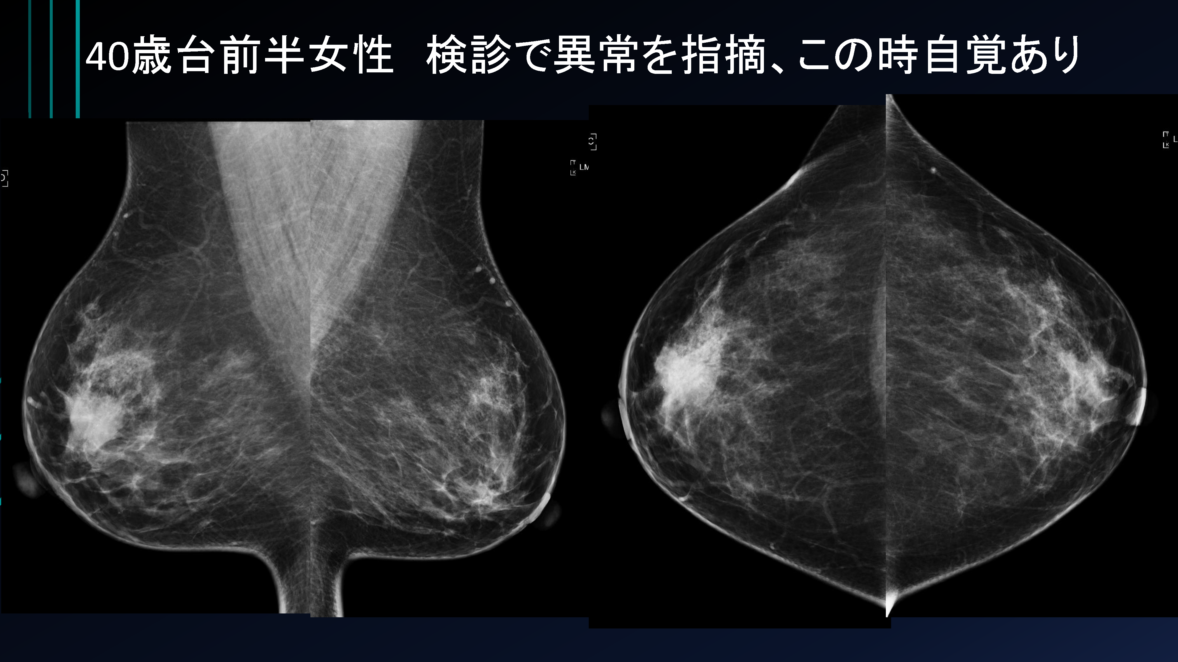 ページ33