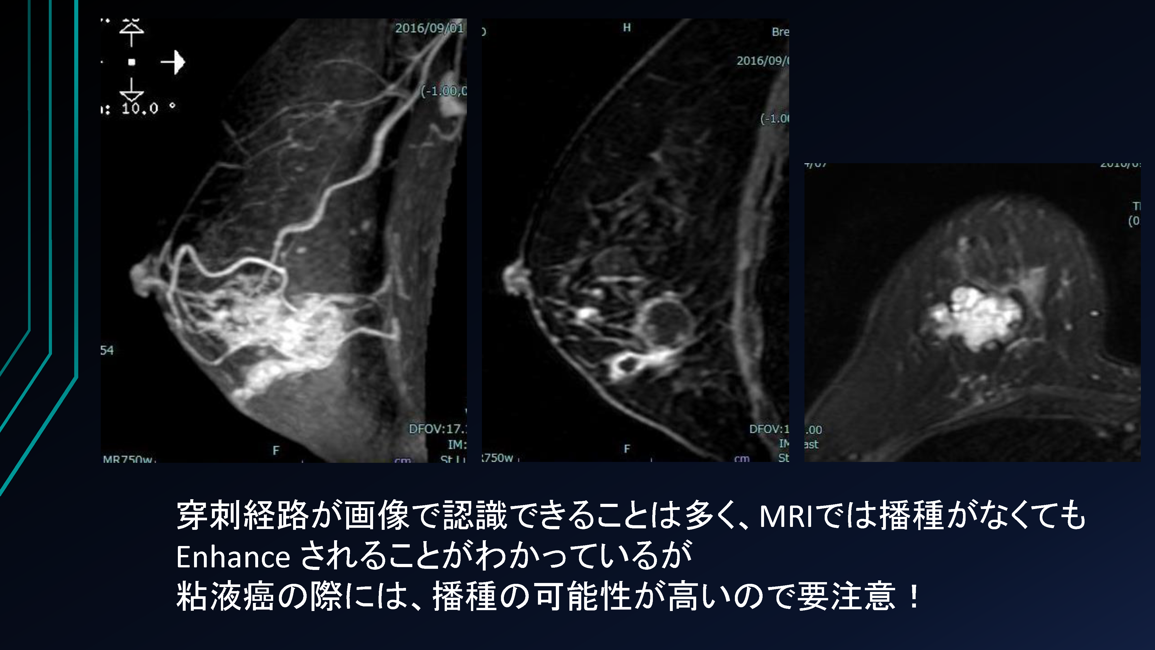 ページ38