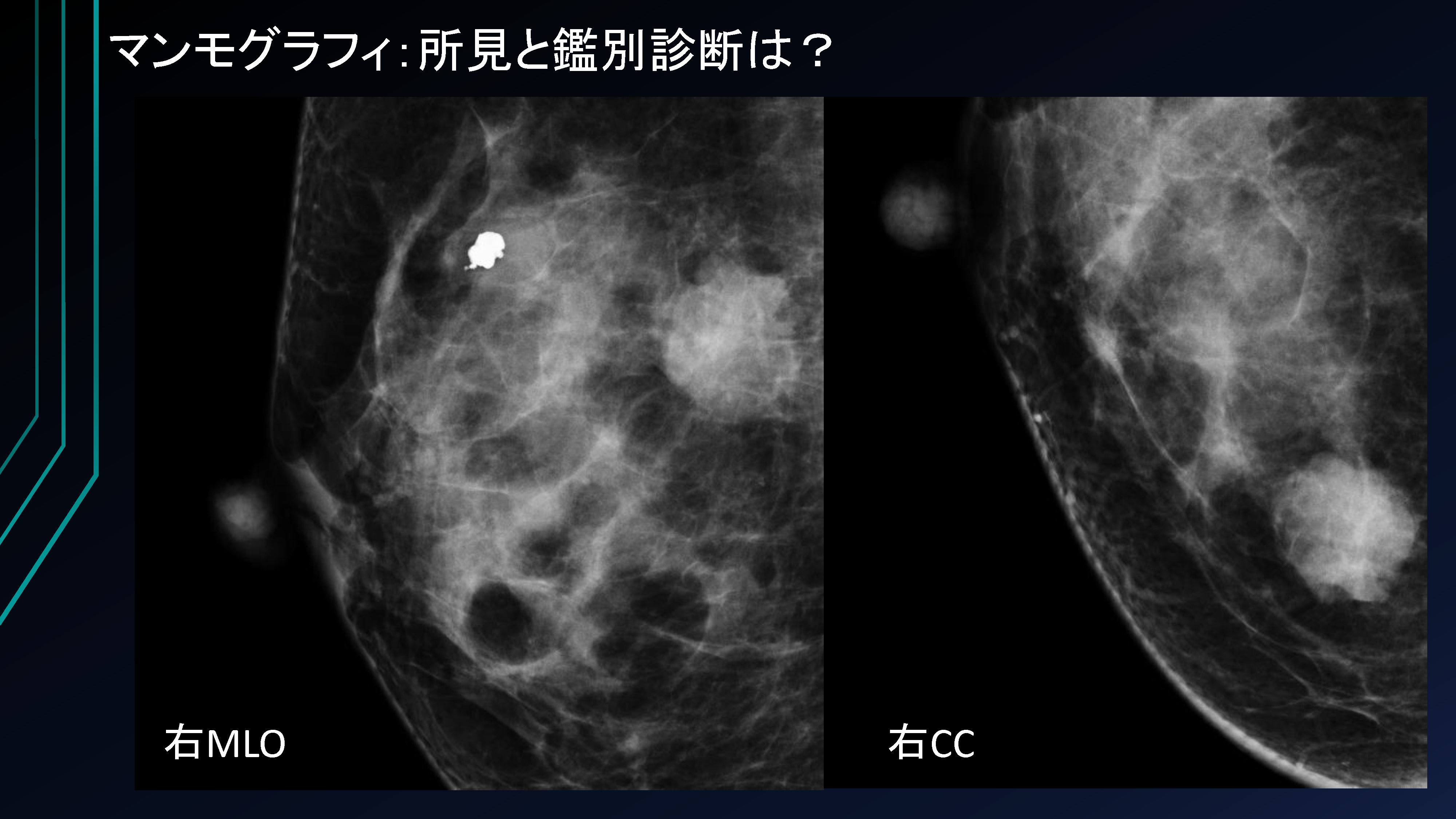 ページ5