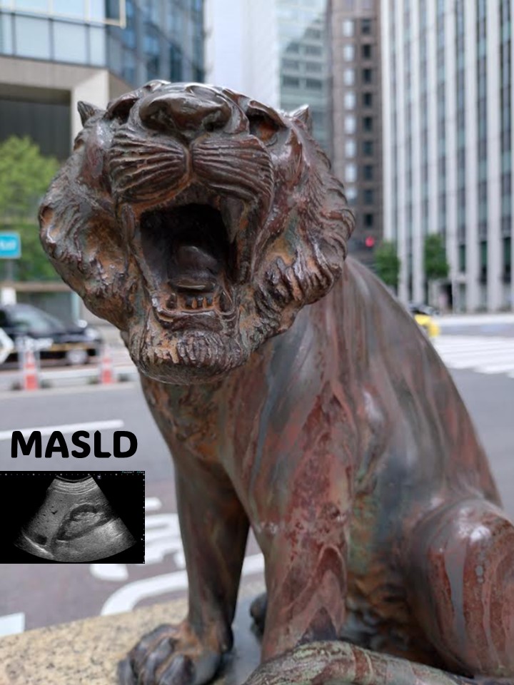 ゲッ！！！　MASLD