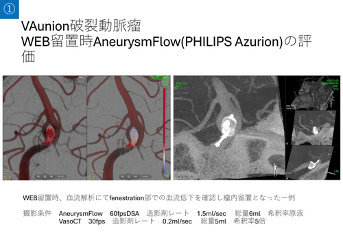 No.1 サムネイル