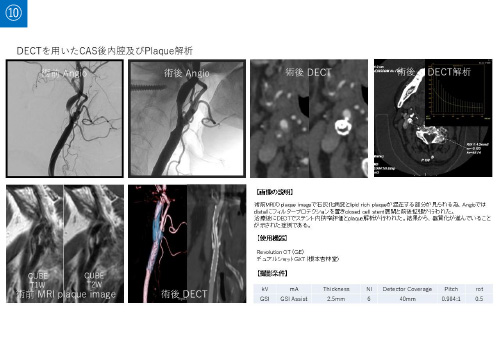 No.10 サムネイル