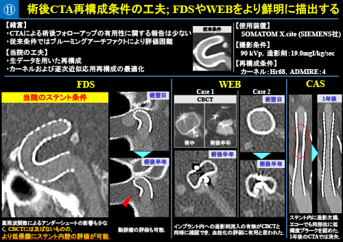 No.11 サムネイル