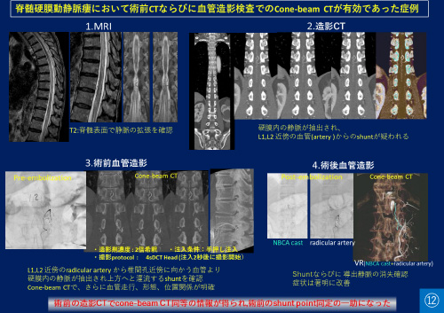 No.12 サムネイル