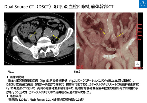 No.13 サムネイル