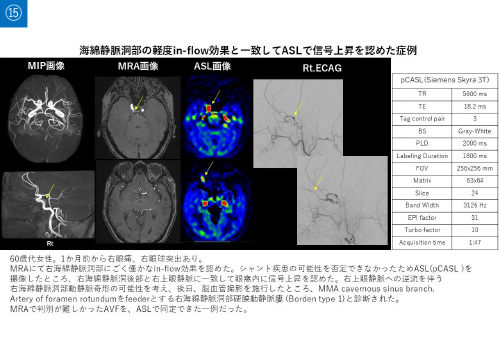No.15 サムネイル