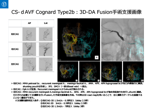 No.17 サムネイル