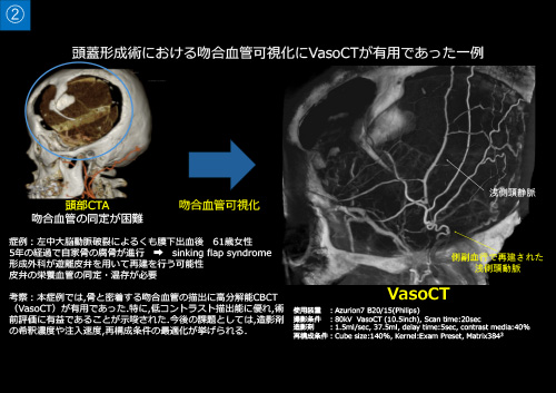 No.1 サムネイル