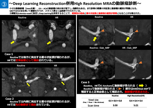 No.1 サムネイル