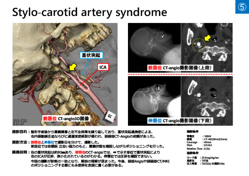 No.5 サムネイル