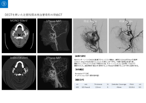 No.9 サムネイル
